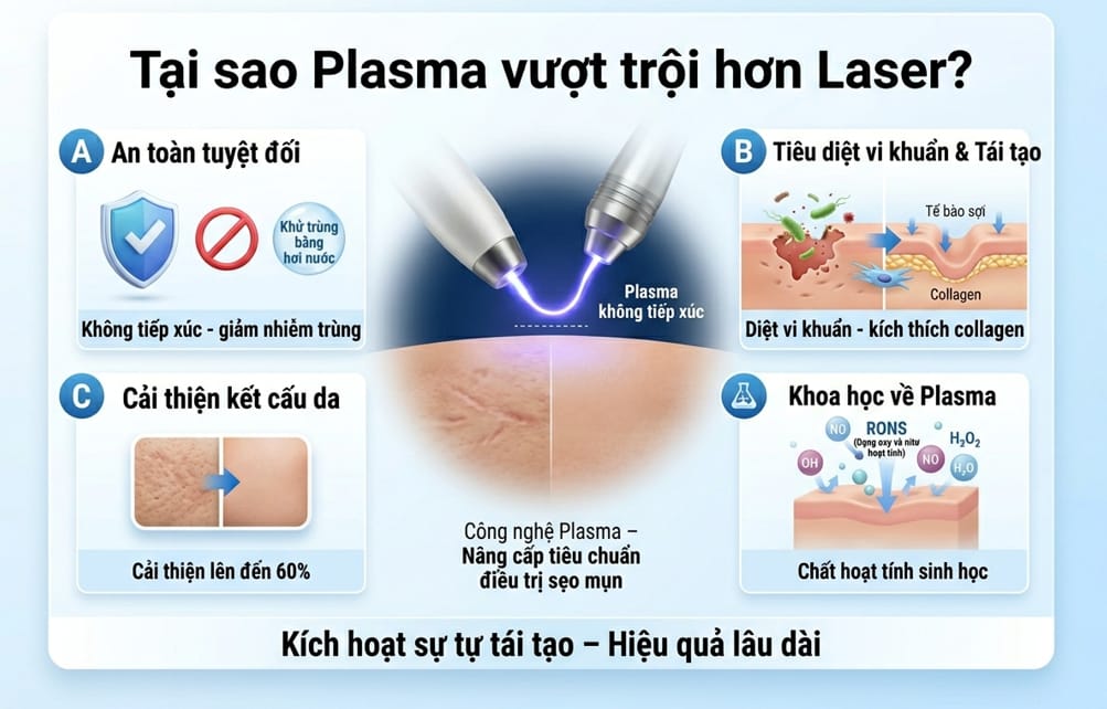 tại sao plasma vượt trội hơn laser - olympia