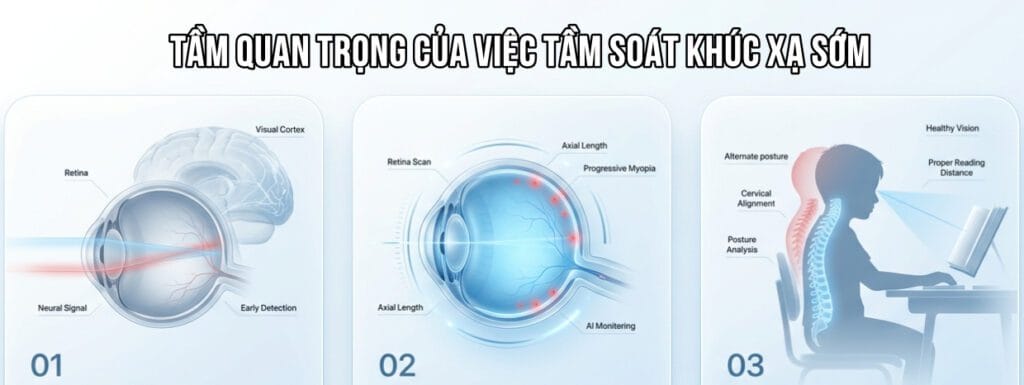 Tầm Quan Trọng Của Việc Tầm Soát Khúc Xạ Sớm