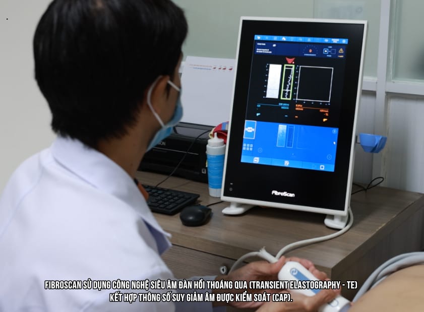 FibroScan sử dụng công nghệ siêu âm đàn hồi thoáng qua (Transient Elastography - TE) kết hợp thông số suy giảm âm được kiểm soát (CAP).