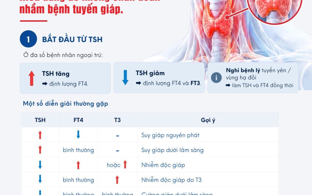 TSH – FT4 – T3: Hiểu đúng để không chẩn đoán nhầm bệnh tuyến giáp