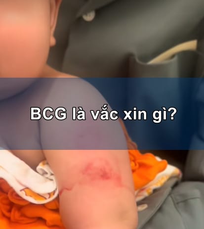 BCG là vắc xin gì