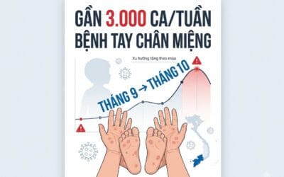 Gần 3.000 ca tay chân miệng mỗi tuần – Vì sao tháng 9–10 cần đặc biệt lưu ý?