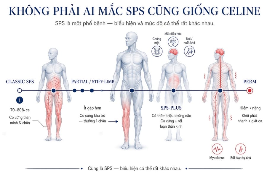 Sơ đồ 4 thể lâm sàng của hội chứng người cứng: Classic, Partial, SPS-plus, PERM