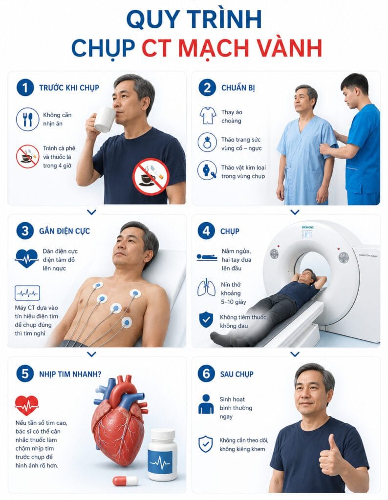 quy trình chụp ct mạch vành