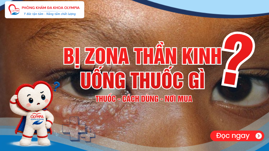 Bị zona thần kinh uống thuốc gì