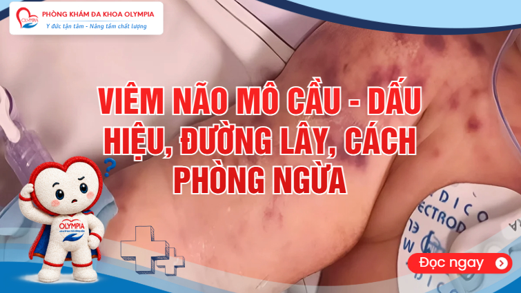 Viêm não mô cầu - dấu hiệu, đường lây, cách phòng ngừa